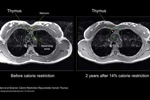 Key Protein Identified That Could Be Harnessed to Extend Healthy Lifespan in Humans