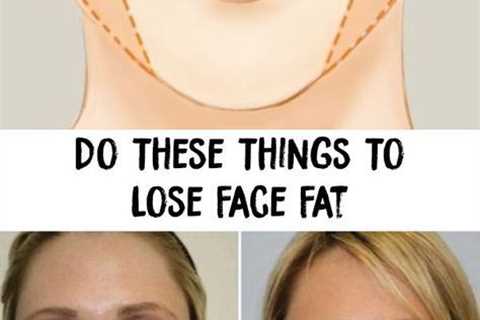 How to Lose Weight in Your Neck and Create a Slimmer Appearance