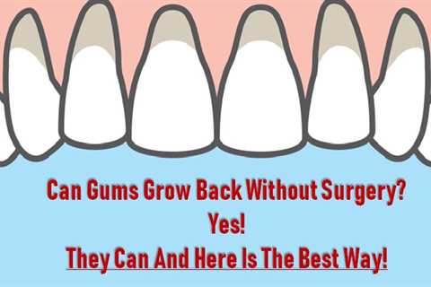 Do Receding Gums Ever Grow Back?