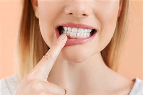 Reverse Receding Gums With Natural Home Remedies