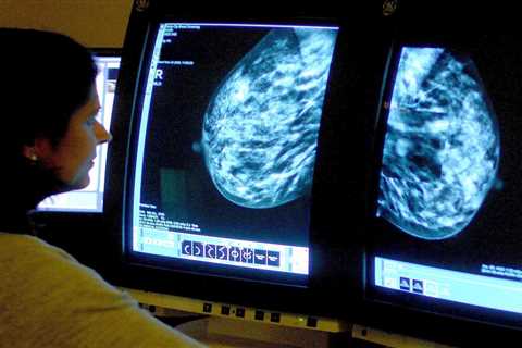 Thousands of women with breast cancer could benefit from new NHS-approved pill