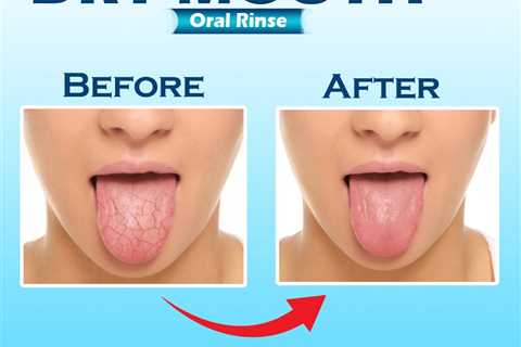 how to cure dry mouth at night