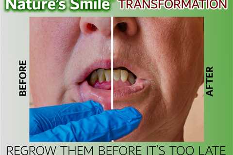Natures Smile and Tooth Sensitivity