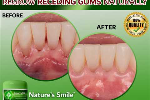 Natures Smile Online