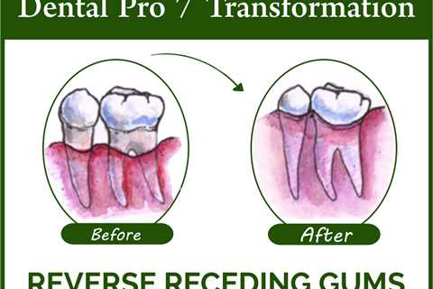 Ingredients in Dental Pro 7