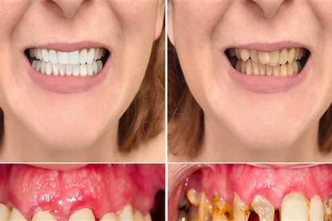 Can dentists make your teeth perfect?