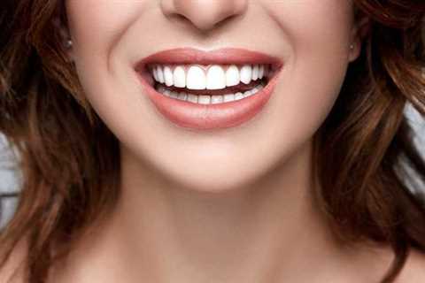 Natures Smile Active Ingredient