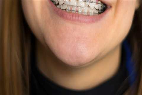 Are orthodontics considered cosmetic?