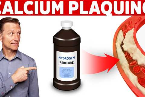 #1 Top Remedy for Calcium Plaque in Your Arteries