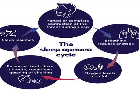 Causes of Sleep Paralysis