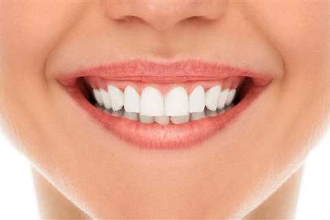 Nature's smile Before and After Reviews - Royaltribune