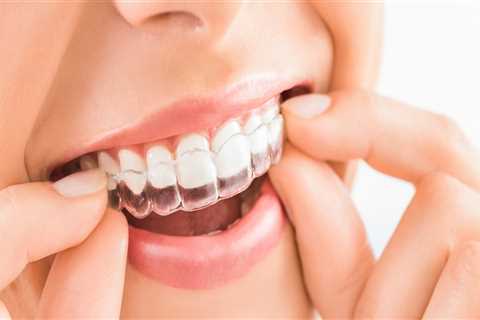 5 Tips to Choose the Best Invisalign Orthodontist