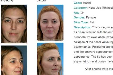 Lakeshore Facial Plastic Surgery