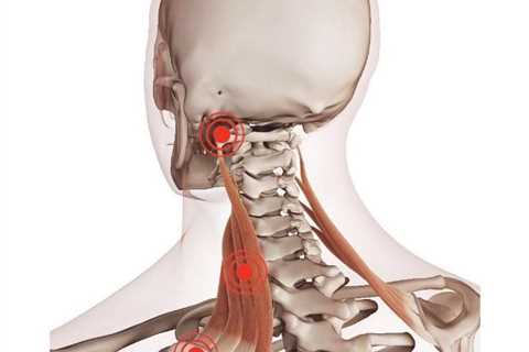 Levator Scapulae Pain: Unraveling the Mystery and Finding Relief