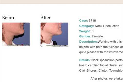 Lakeshore Facial Plastic Surgery