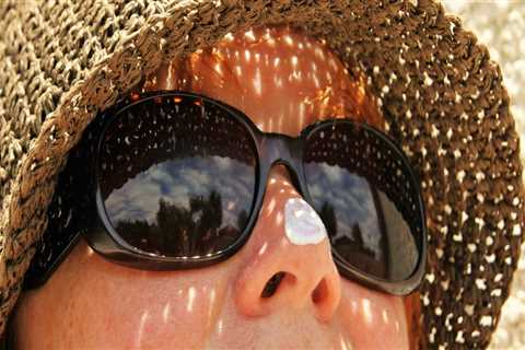 Protect Yourself from Skin Cancer: Understanding the Risk Factors