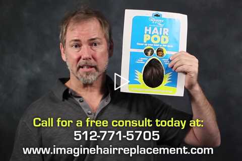 Balding Solutions For Men And Women