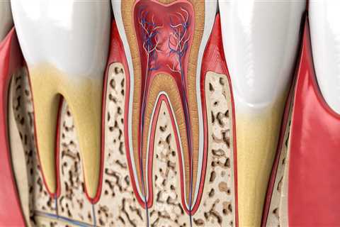 When is Endodontics Needed?