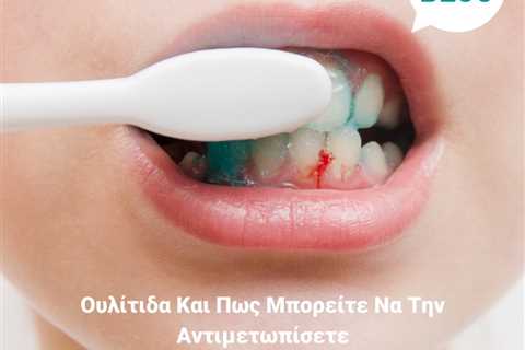 Standard post published to Smalto Dental Clinic at May 12, 2023 10:00