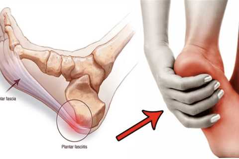 Understanding Plantar Fasciitis: Causes, Symptoms, and Treatment - Swabhava.org