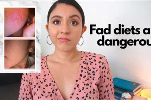 How Fad Diets Destroyed My Health | How to spot a fad diet!