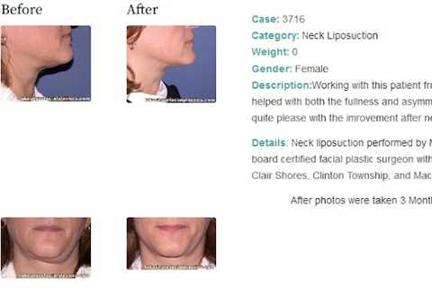 Lakeshore Facial Plastic Surgery