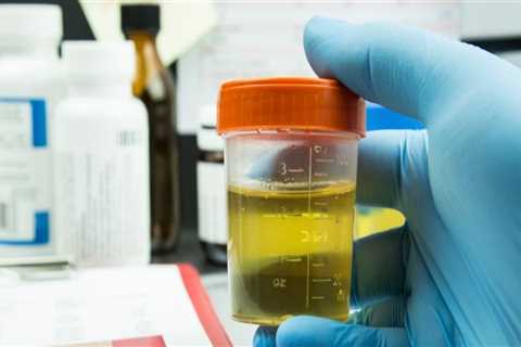 Can Hemp or CBD Show Up in Urine Tests?