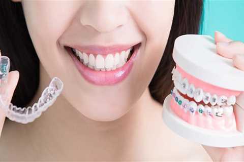 Transform Your Smile With Clear Invisalign Braces From An Expert Invisalign Dentist In Austin