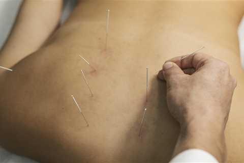 Acupuncture Online Training