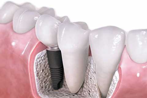 Standard post published to Symeou Dental Center at August 09, 2023 10:00
