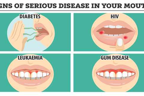 Signs of Serious Disease Hiding in Your Mouth – From Cancer to HIV and How to Check