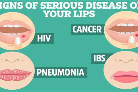 The 4 Serious Diseases You Can Spot on Your Lips - From Cancer to Pneumonia