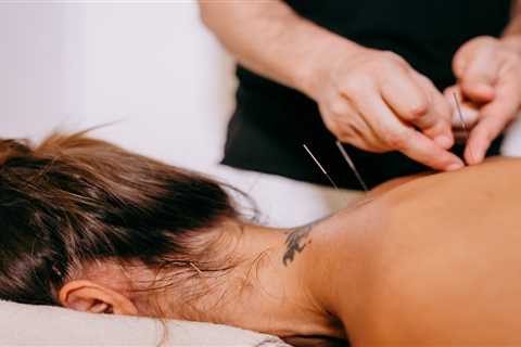 THE ROLE OF ACUPUNCTURE IN PAIN MANAGEMENT