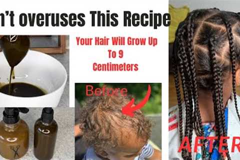 Don’t Overuse this Recipe because Ur Hair Won’t Stop Growing| Ur Hair Will Grow Up To 9 Centimeters.
