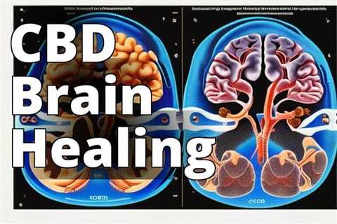 CBD for Brain Healing: Unveiling Its Neuroprotective Power