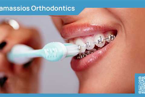 Standard post published to Tamassios Orthodontics - Orthodontist Nicosia, Cyprus at February 12,..