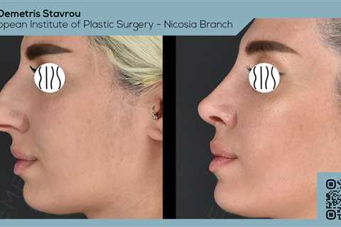 Standard post published to Dr. Demetris Stavrou - European Institute of Plastic Surgery - Nicosia..