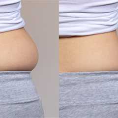 Lakatamia: Enhance Your Body Shape with Liposuction Services by Dr. Demetris Stavrou