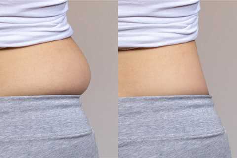 Lakatamia: Enhance Your Body Shape with Liposuction Services by Dr. Demetris Stavrou