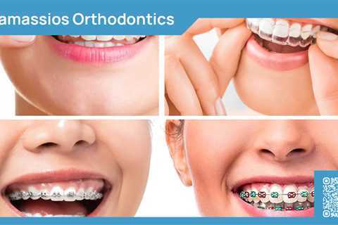 Standard post published to Tamassios Orthodontics - Orthodontist Nicosia, Cyprus at March 22, 2024..