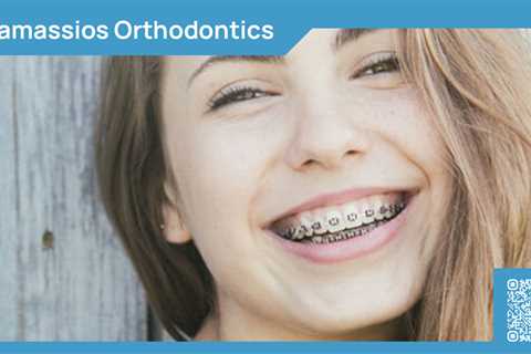 Standard post published to Tamassios Orthodontics - Orthodontist Nicosia, Cyprus at March 31, 2024..