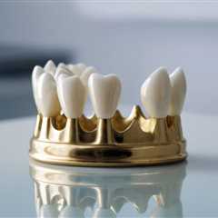 Alles über Zahn Kronen: Funktionen, Kosten und Pflege