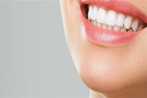 Different Methods for Whitening Teeth: A Comprehensive Guide