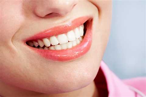 Knowing the Difference Between Invisalign and Braces