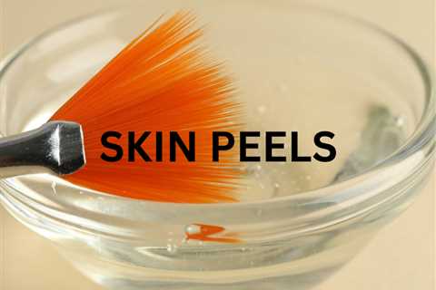 Unlock the Secret to Radiant Post-Summer Skin with a TCA Peel