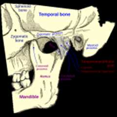 Temporomandibular Joint Disorder