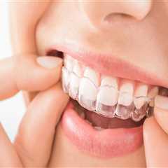 Invisible Braces, Visible Results: Your Guide To The Best Invisalign Dentist In North Kansas City