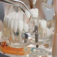 Will dental implants get cheaper?