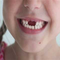 Helping Your Child Smile Again: Teeth Implants For Kids In Summerville, SC