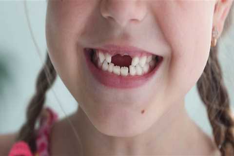 Helping Your Child Smile Again: Teeth Implants For Kids In Summerville, SC